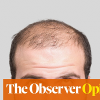 Let’s not mock bald men. But do they really feel threatened? | Stephanie Merritt