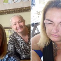 Nan face-plants TOILET after having too much fun at bottomless brunch