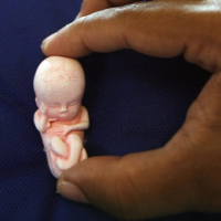 World Health Organization Preps for Assault on Pro-Life Laws