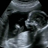 ‘Short Window of Time’: Texas Abortion Ban Forces Pregnancy Centers to Pivot