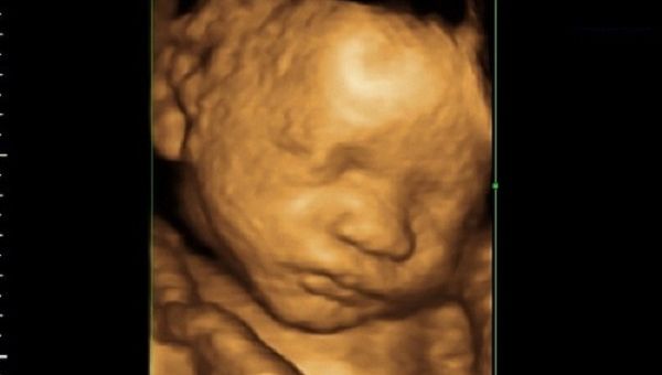 Indiana Planned Parenthood Sues to Overturn Abortion Ban So It Can Kill Babies – LifeNews.com