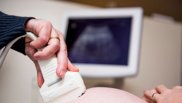 Idaho Passes ‘Texas-Style’ Six-Week Abortion Ban Law – Conservative Angle